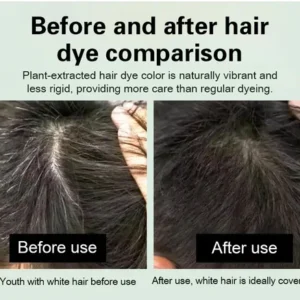🎁EK K SAATH 1 MUFT LIMITED TIME OFFER 🔥✨Japanese Long Lasting Natural Hair Dye Shampoo - Image 11