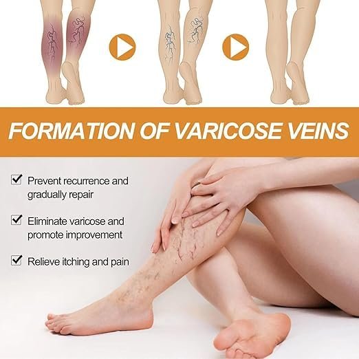 đEK K SAATH 1 MUFT LIMITED TIME OFFERđ„Turmeric Varicose Vein Relief Spray (100ML + 100ML) - Image 5